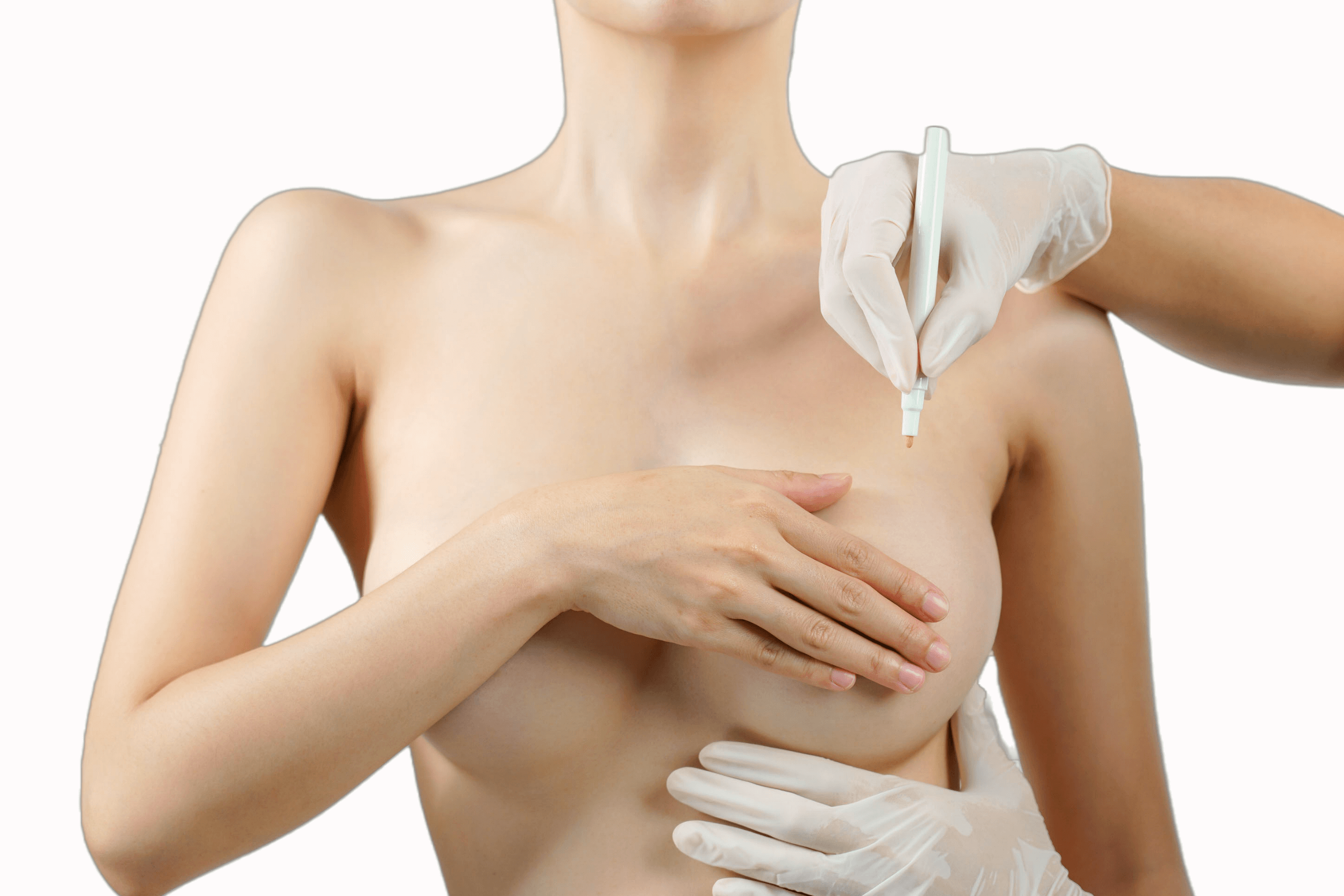 Breast Cancer Breast Reconstruction Plastic Surgeon Julian Liew