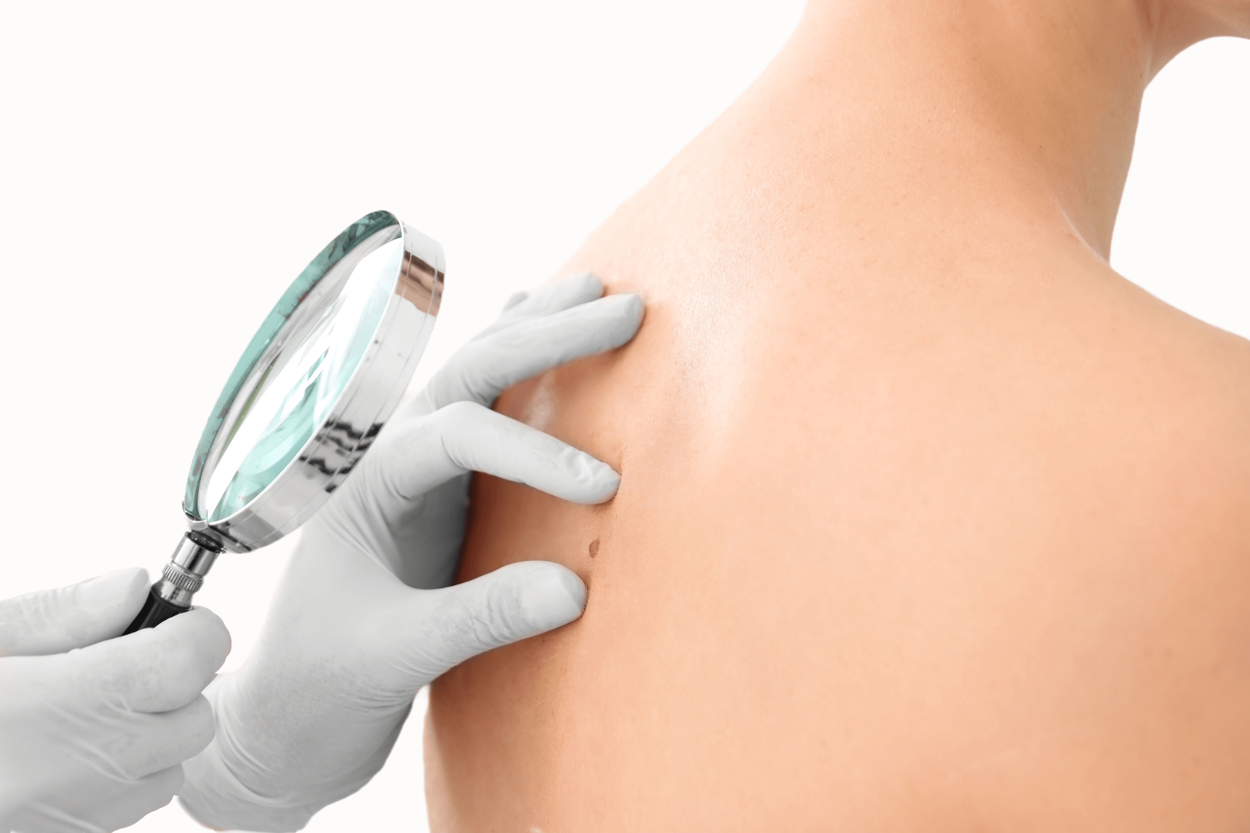 Skin Cancer Surgery The Clinic Plastic Surgery Dr Julian Liew 