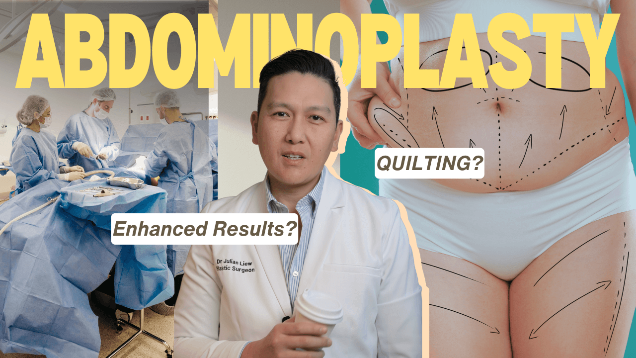 dr Julian Liew abdominoplasty tummy tuck